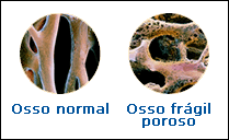 Osso