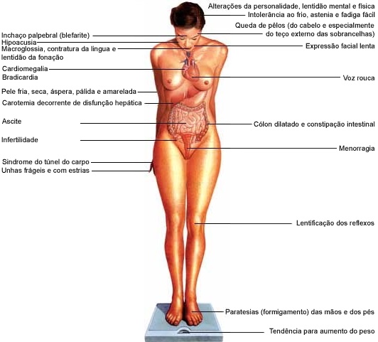 Efeitos do Hipotireoidismo