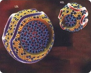 HDL-LDL