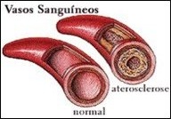 Vasos sanguíneos